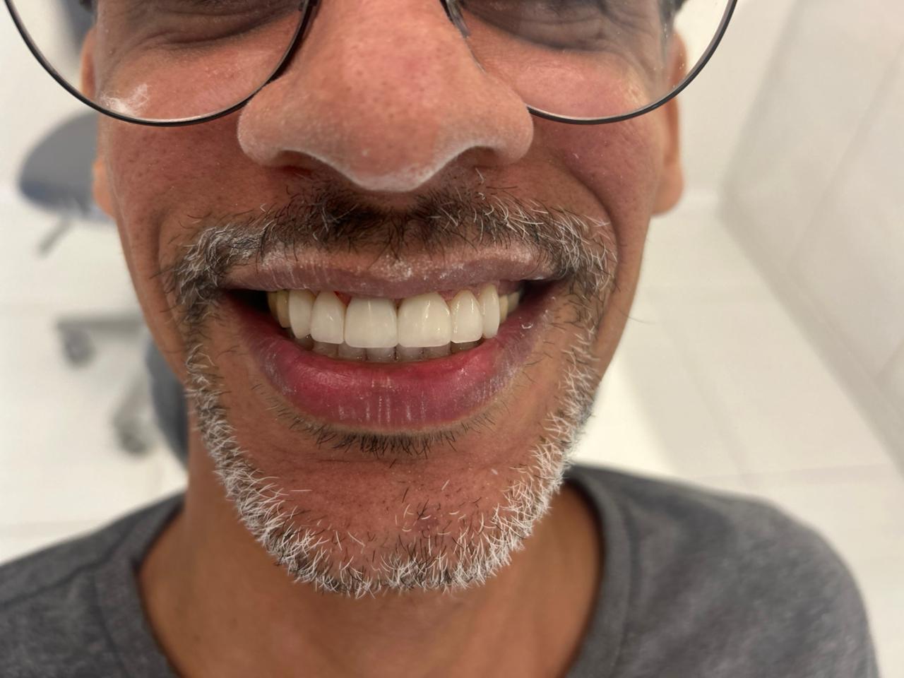 Sorriso do paciente depois do tratamento
